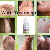10ML Body Warts Treatment Cream Skin Tag Remover Foot Corn Removal Plantar Genital Warts Ointment Foot Care Cream Dropshopping