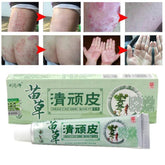Chinese Herbal Medicine Skin Cream For Anti-itch Allergies Dermatitis Eczema Pruritus Psoriasis Ointment External Use Plaster