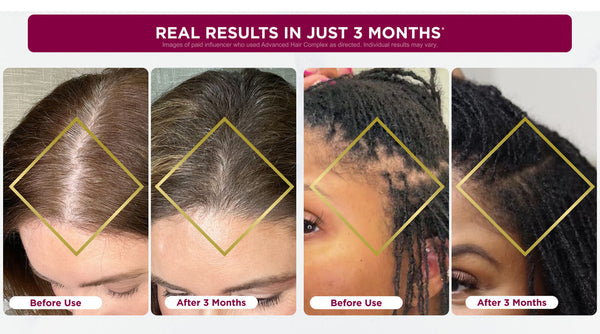 Hair Growth |Supports Growth of Thicker,Fuller Hair,60 Count 2bottles