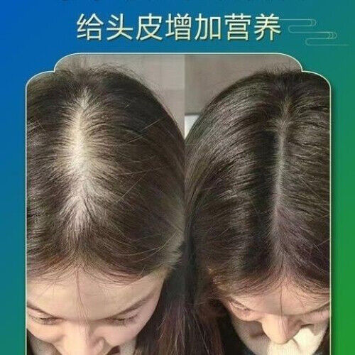 Chinese Arborviae Twig and Leaf Powder He Shou Wu Ginger Powder Anti Hair Loss
