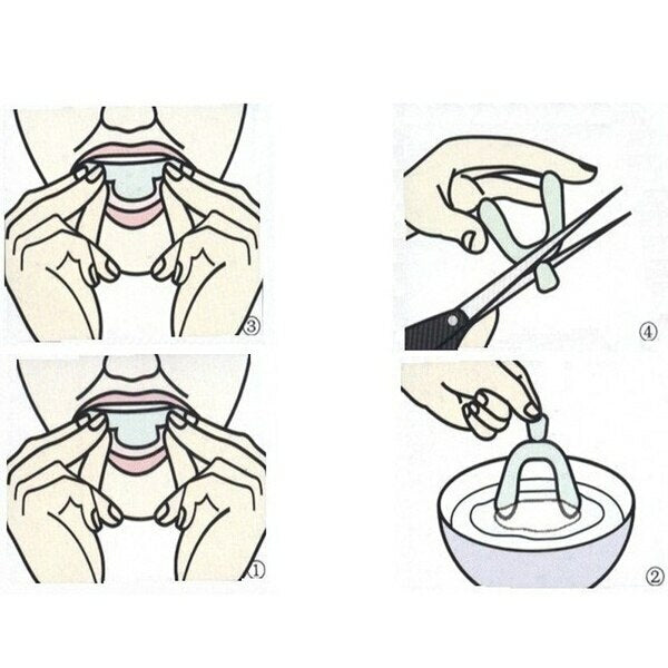 2Pairs Sleeping Mouth Guard Stop Teeth Grinding Anti Snoring Bruxism Eliminates