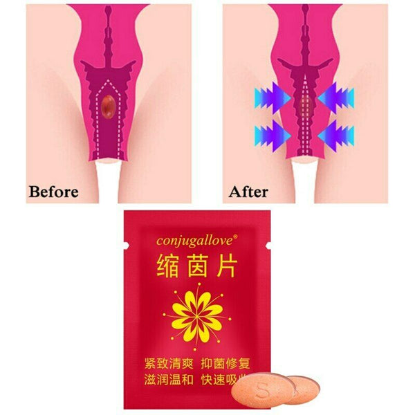 Nv Shi Si Chu Shou Suo Jin Zhi Hu Li Xiu Fu Shuang女士私处收缩紧致护理修复霜
