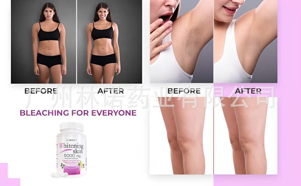 Easy toabsorb Whitening Skin 5000mg capsule|L-GLUTATHIONE PILLS-60/120caps