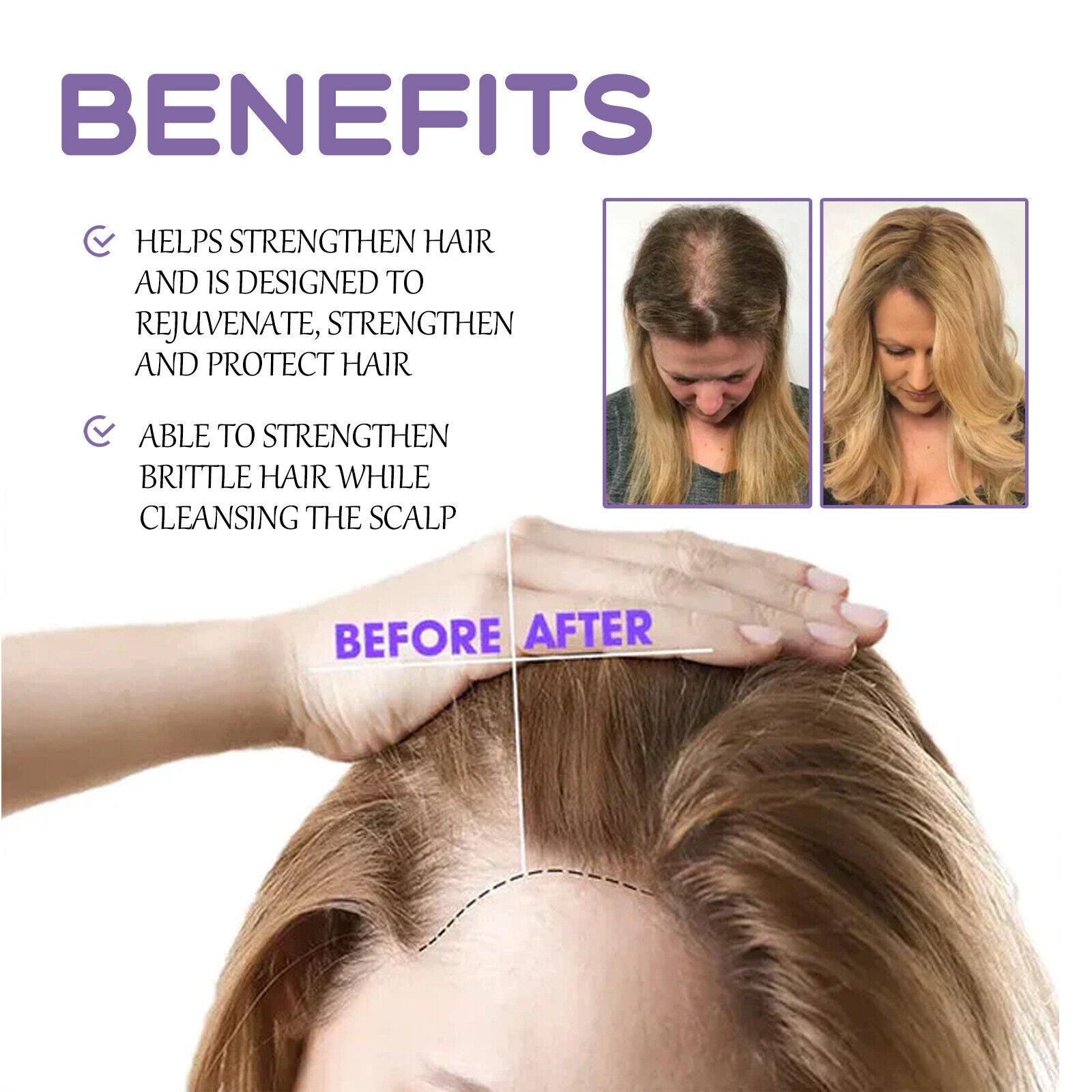 Follicle Dense Hair Drops Repair Follicles Hair Nourish Hair Root Thickening30ml Secondary image