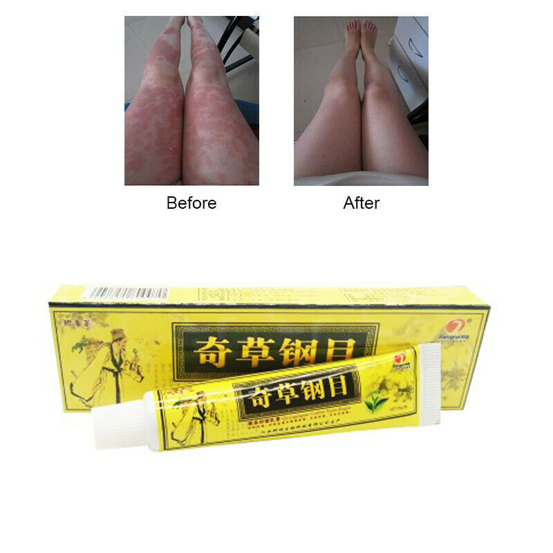 Chinese Medicine Advanced Body Psora PS Cream Perfect for Ointment Herbal Creams Main image
