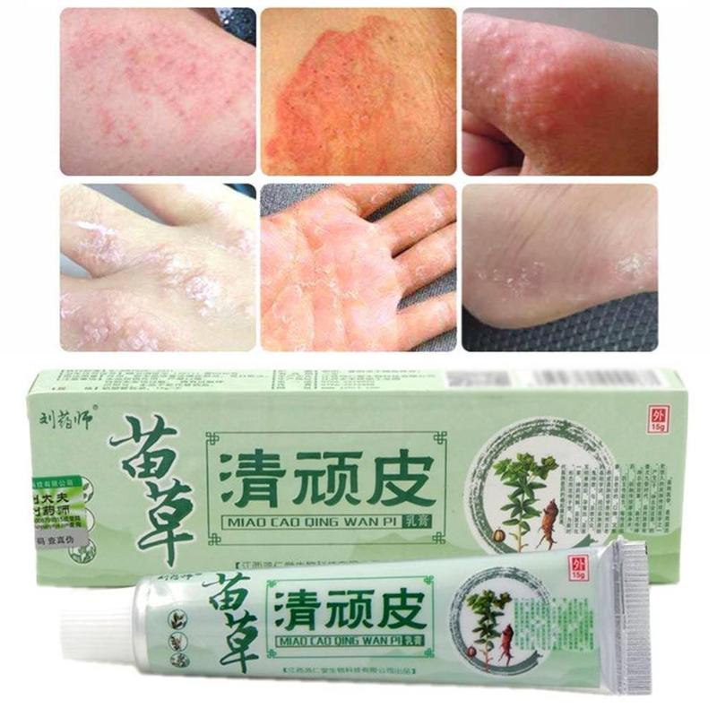 Chinese Herbal Medicine Skin Cream For Anti-itch Allergies Dermatitis Eczema Pruritus Psoriasis Ointment External Use Plaster Secondary image