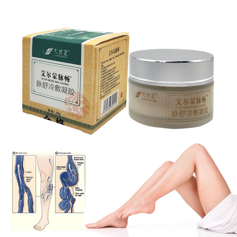 Varicose Veins Cream Of Varicose Veins Medical Spider Veins Treatment Chinese Herbal Medicine Varicose Veins Ointment 20g Main image