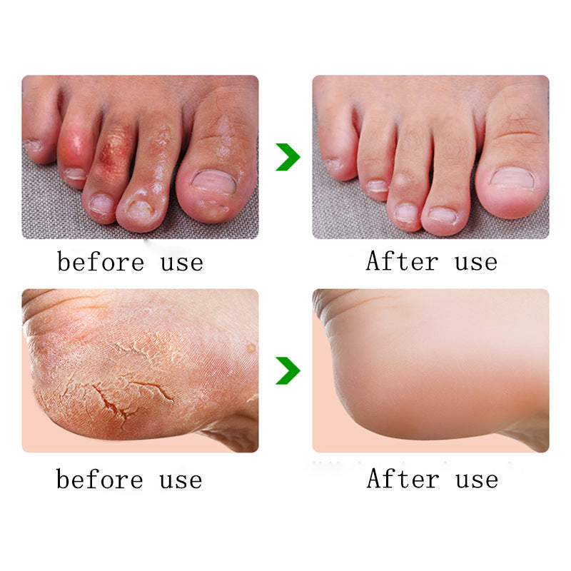 Anti Dry Crack Powerful Frozen Cracking Cream Prevent Repair Skin Dry Chapped Frozen Frostbite Chinese Medicinal Ointment Main image