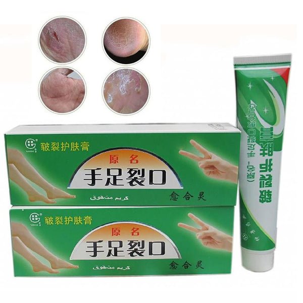 Plantar Crack Care Cream 100% Herbal Hand Foot Skin Splitting Cure Hydrating Ointment Chinese Medicine Cleft Treatment Plaster