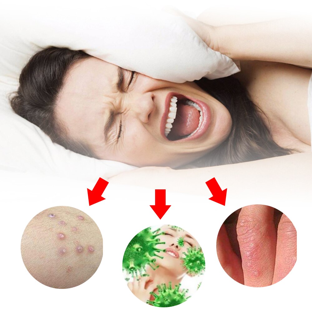 1Pcs Anti-itch Cream Pain Removal Eczema Psoriasis Ointment Dermatitis Chinese Herbal Medical Plaster Health Care Main image