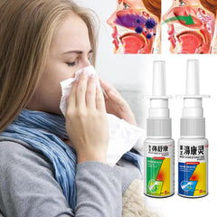 Nasal Herb Spray Chronic Allergic Rhinitis Sinusitis Treatment Nose Congestion Relief Traditional Medical Nose Care Liquid 30ml