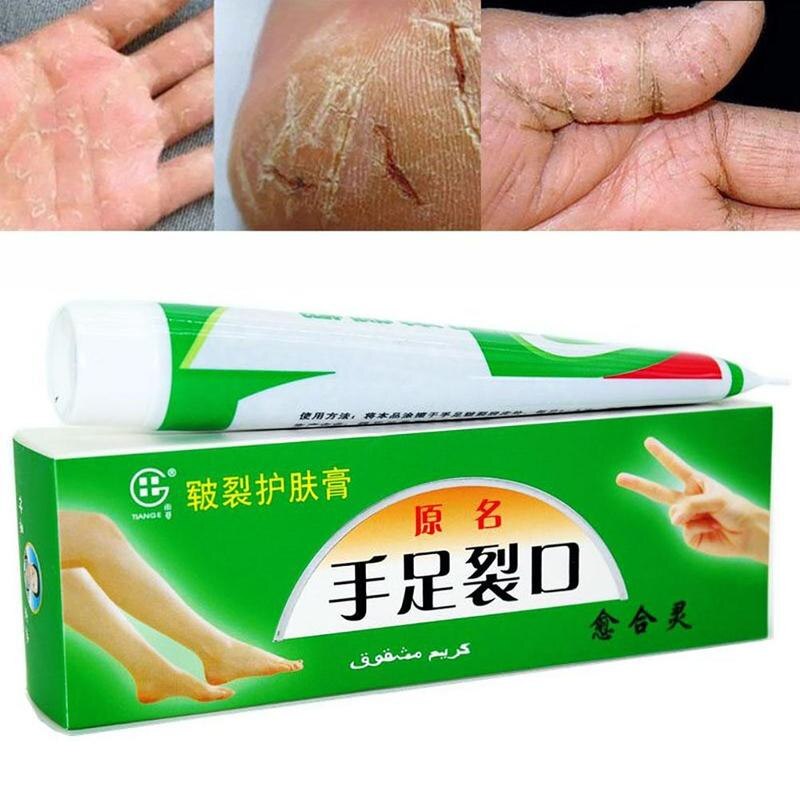 Plantar Crack Care Cream 100% Herbal Hand Foot Skin Splitting Cure Hydrating Ointment Chinese Medicine Cleft Treatment Plaster