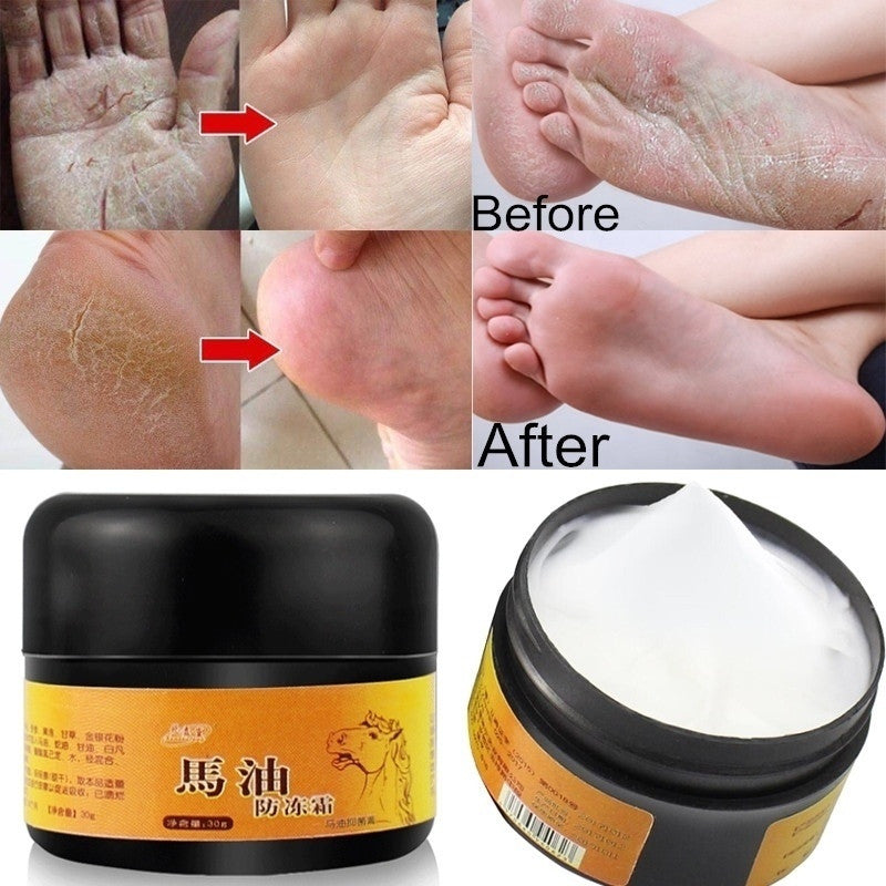 Horse Oil Foot Hand Antifreeze Cream Treatment Dry Skin Heel Chapped Peeling Repair Anti Chapping Wrinkle Treatment Ointment Main image