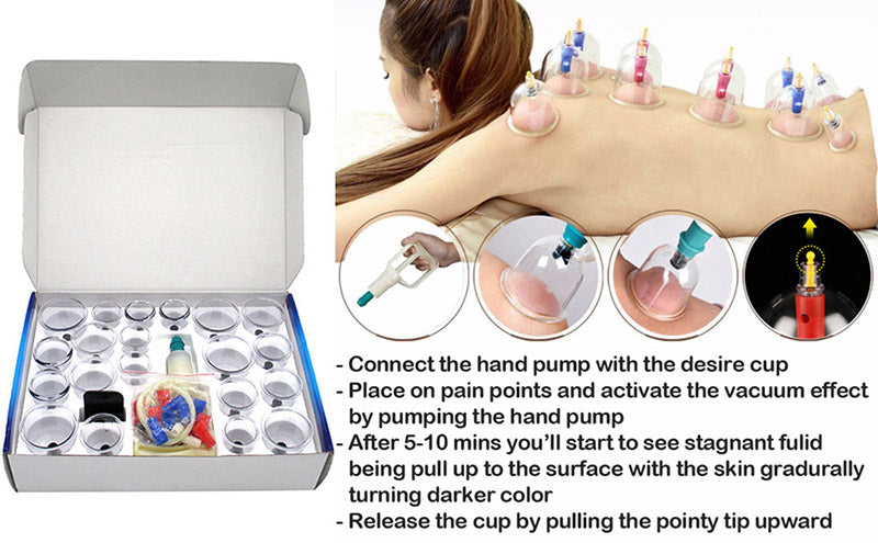 12/24pcs/set Vacuum Cupping Device Suction Cups Medical Sucker Magnetic Treatment Apparatus Banks Body Massage Cans