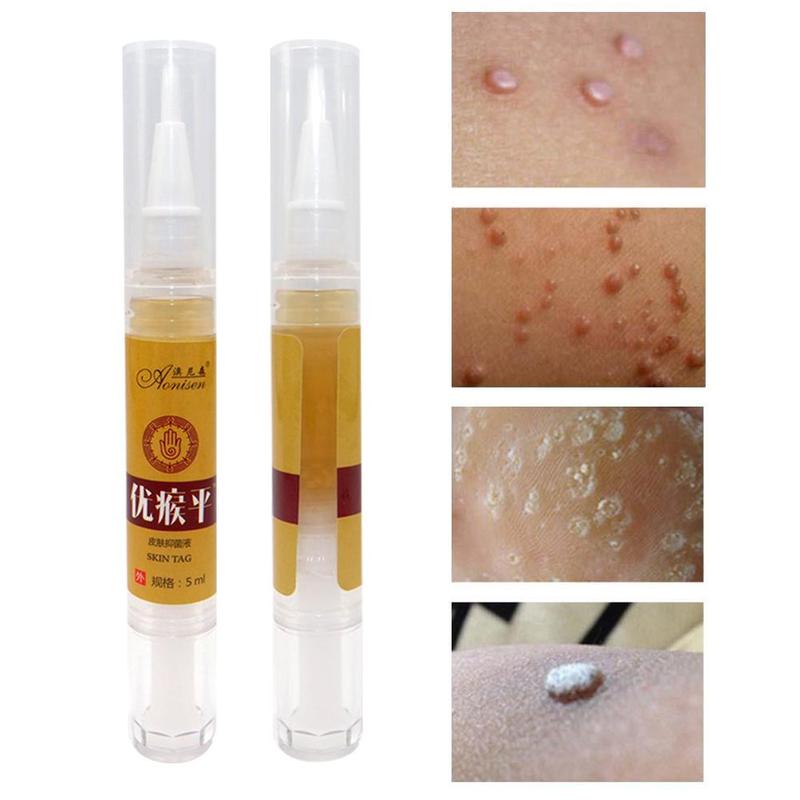 Skin Tag Remover Pen 12 hours Tu kill Medical Tu kill Remover Skin Tag Mole & Genital Wart Remover Foot Corn Removal Pen Main image