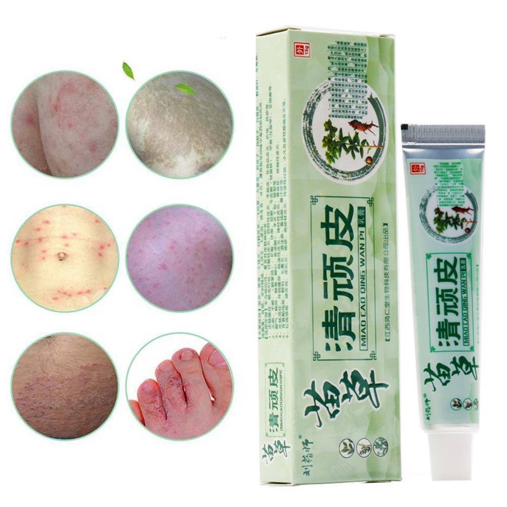 Health psoriasis treatment cream Skin care Dermatitis Eczematoid Eczema Ointment eczema cream psoriasis Itching relief Ointment