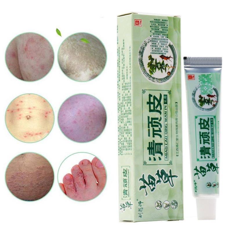 Chinese Herbal Medicine Skin Cream For Anti-itch Allergies Dermatitis Eczema Pruritus Psoriasis Ointment External Use Plaster