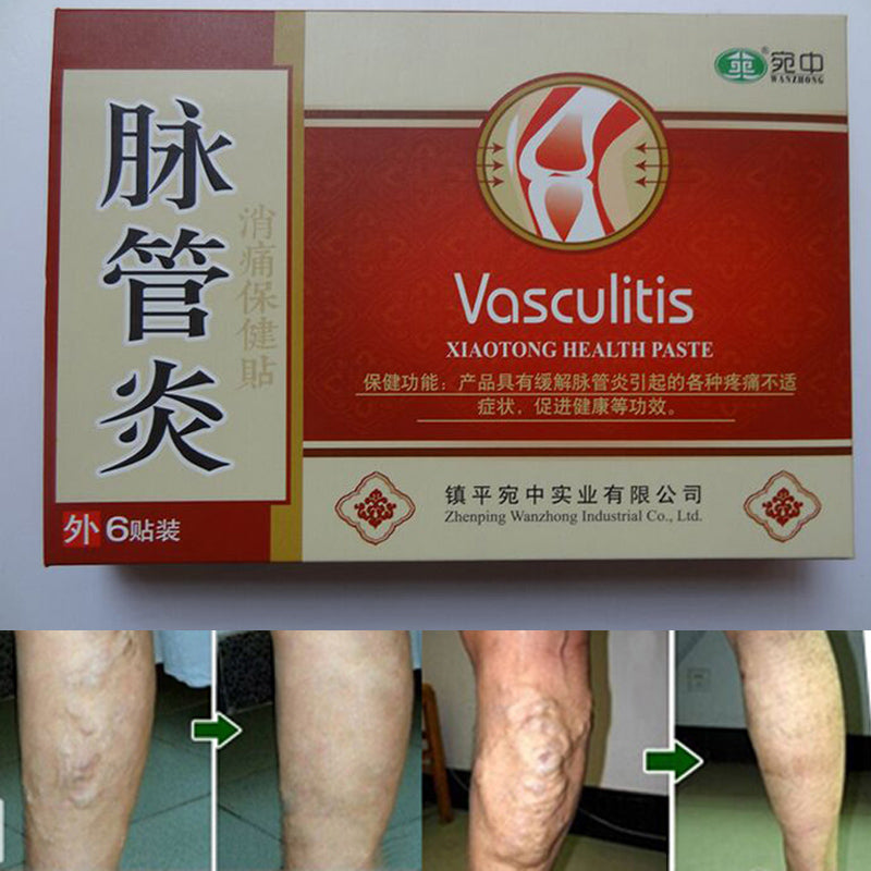 Spider Veins Varicose Treatment Plaster Varicose Veins Cure Patch Vasculitis Natural Solution Herbal Patches 24 Pcs