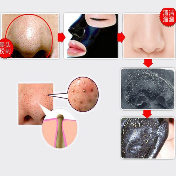 Black Face Patch Nose Strips Remove Blackheads Pores Black Head Remover Acne Peel Mask Black Dots Cleaning Medical Plaster 1bag