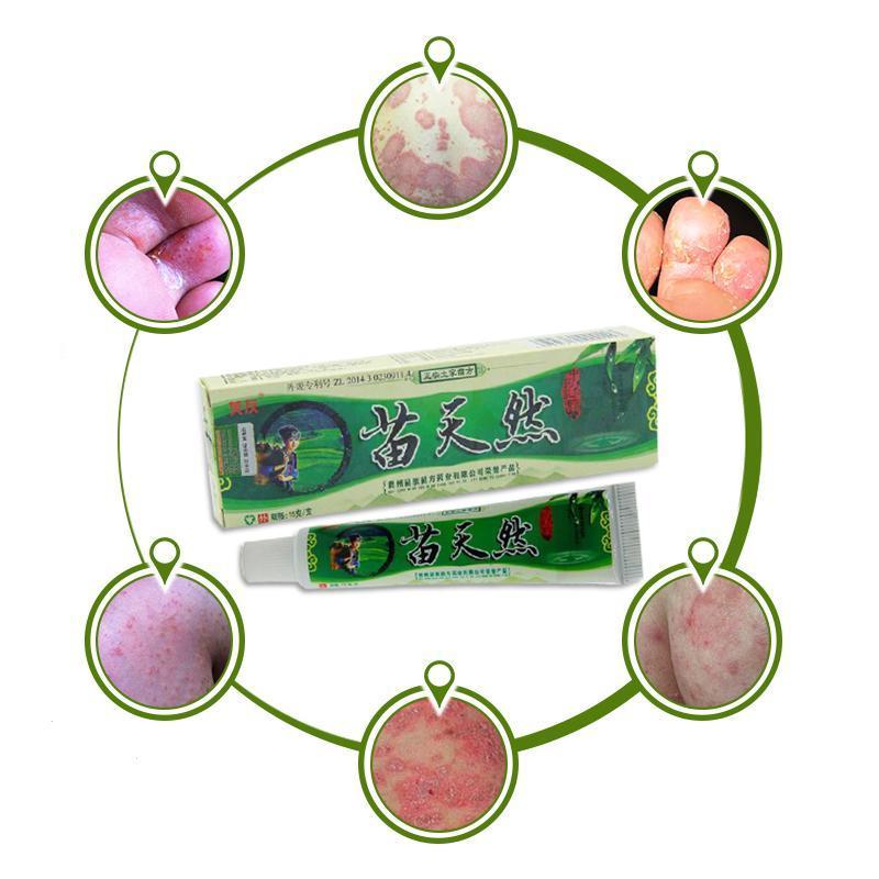 New Miao natural bacteriostatic ointment hemorrhoids Gels herbal Body Psoriasis Cream Plasters with Retail Box Skin Care 15g Secondary image