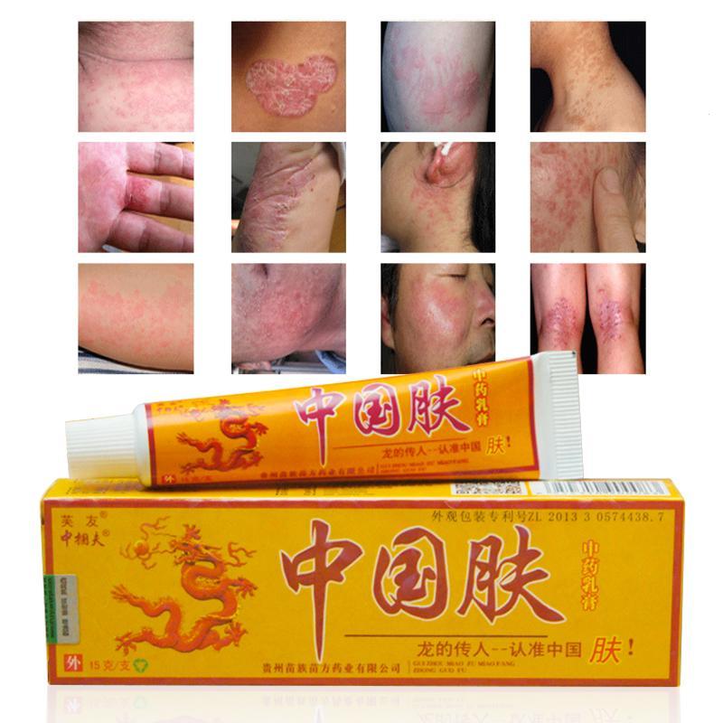 Natural Chinese Medicine Herbal Anti Bacteria Cream Psoriasis Eczema Ointment Skin Problem Repair Treatment Health Care 15g