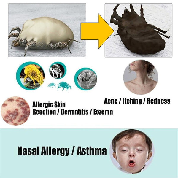 Herbal Dust Mite Eliminator Mite Remover Reduces Acne & itching Safe for use on your bed sheets, mattresses, pillows 2 Packs