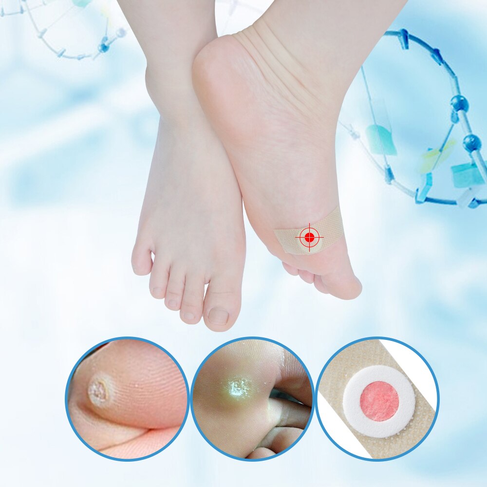 42Pcs Painless Feet Care Foot Medical Corn Remover Warts Thorn Plaster Callus Removal Tool Soften Skin Cutin K03401
