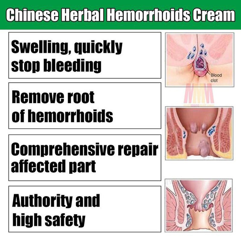 20g Hua Tuo Herbal Hemorrhoids Cream Effective Treatment Internal Hemorrhoids Piles External Anal Fissure Main image