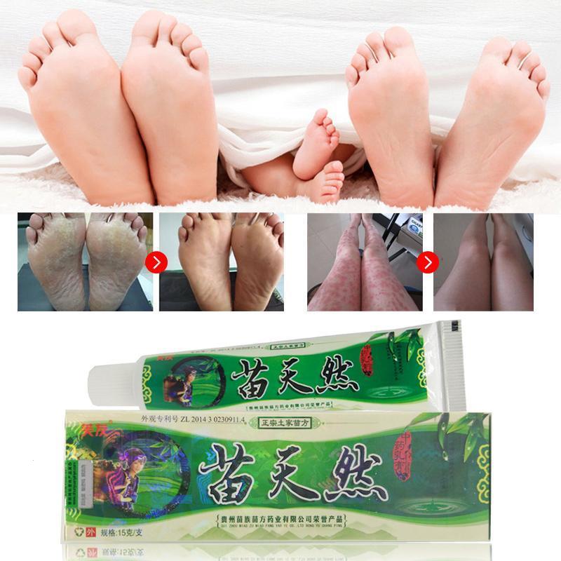 New Miao natural bacteriostatic ointment hemorrhoids Gels herbal Body Psoriasis Cream Plasters with Retail Box Skin Care 15g