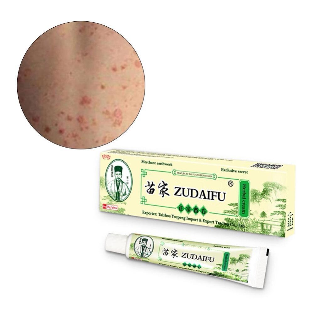 Zudaifu Skin Care Cream Skin Psoriasis Cream Dermatitis Eczematoid Eczema Ointment Treatment Psoriasis Cream Main image