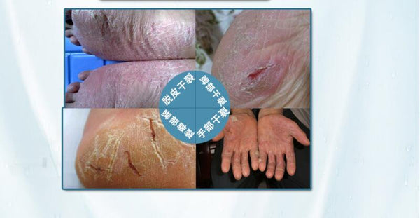 Powerful Chinese Ointment Cream Hand Foot Crack Cream Heel Chapped Peeling Foot and hand Repair Anti Dry Crack skin care