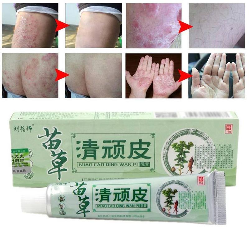 Chinese Herbal Medicine Skin Cream For Anti-itch Allergies Dermatitis Eczema Pruritus Psoriasis Ointment External Use Plaster Main image