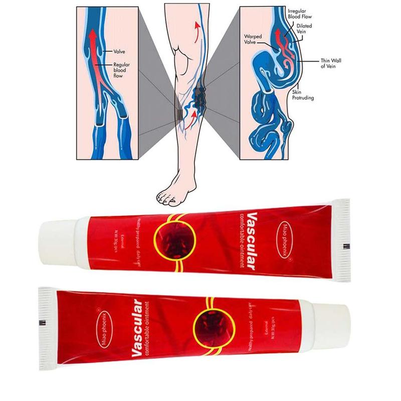 Varicose Veins Treatment Cream Ointment Vasculitis Phlebitis Spider Veins Pain Varicosity Angiitis Remedy Removal Herbal Cream Main image