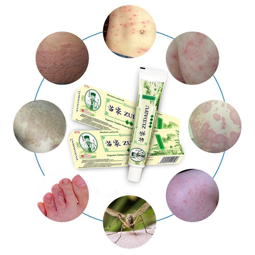 Zudaifu Cream Psoriasis Cream Skin Care Psoriasis Skin Dropshipping Dermatitis Eczematoid Eczema Ointment Treatment Care Cream