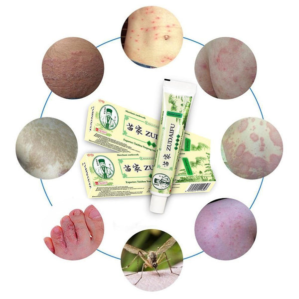 Zudaifu Cream Psoriasis Cream Skin Care Psoriasis Skin Dropshipping Dermatitis Eczematoid Eczema Ointment Treatment Care Cream