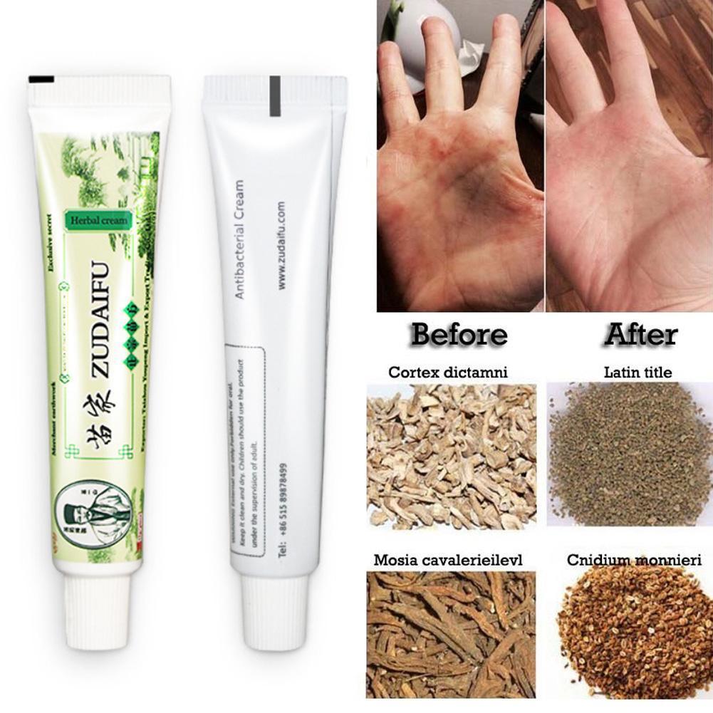 Zudaifu Cream Psoriasis Cream Skin Care Psoriasis Skin Dropshipping Dermatitis Eczematoid Eczema Ointment Treatment Care Cream Secondary image