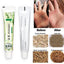 Zudaifu Cream Psoriasis Cream Skin Care Psoriasis Skin Dropshipping Dermatitis Eczematoid Eczema Ointment Treatment Care Cream