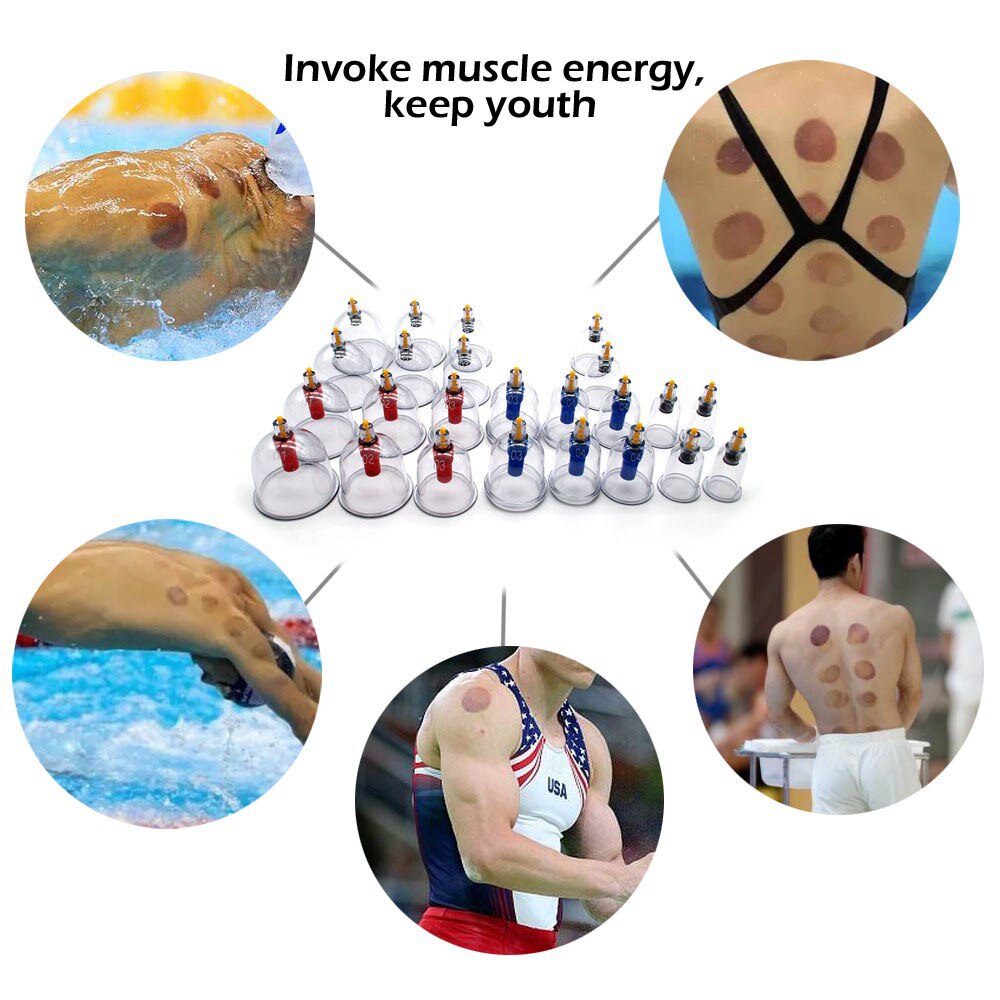 Vacuum Cupping Device Suction Cups Medical Sucker Magnetic Treatment Apparatus Banks Body Massage Cans 12/24pcs/set
