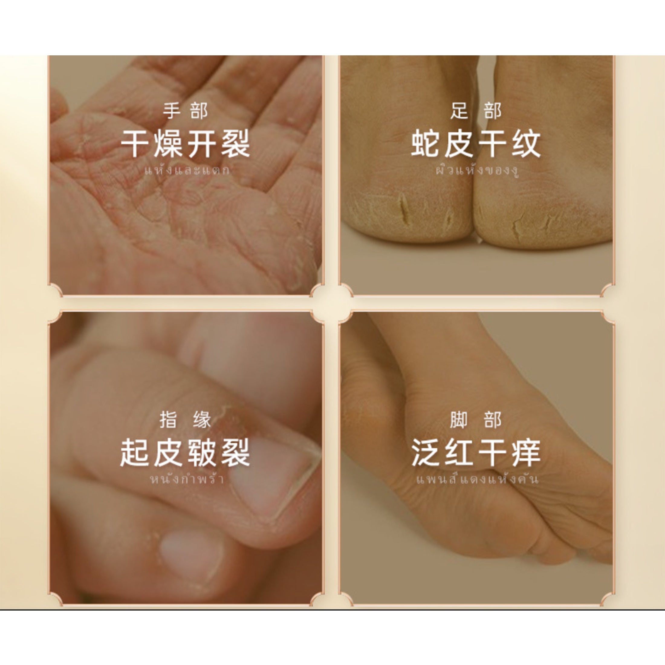 1 Box 15g Natural Banana Oil Anti-Drying Crack Foot Cream Heel Cracked Repair Cream Removal Dead Skin Hand Feet Care