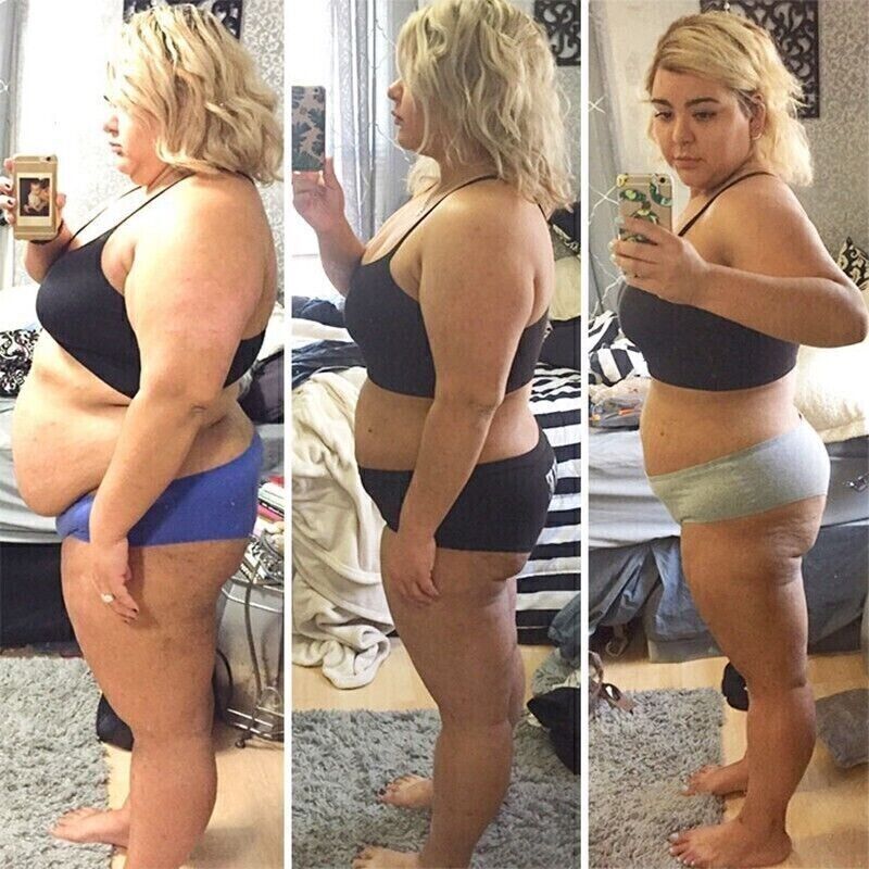 Extreme Appetite Suppressant for Fast Weight Loss - Best Diet Pills to Lose Fat