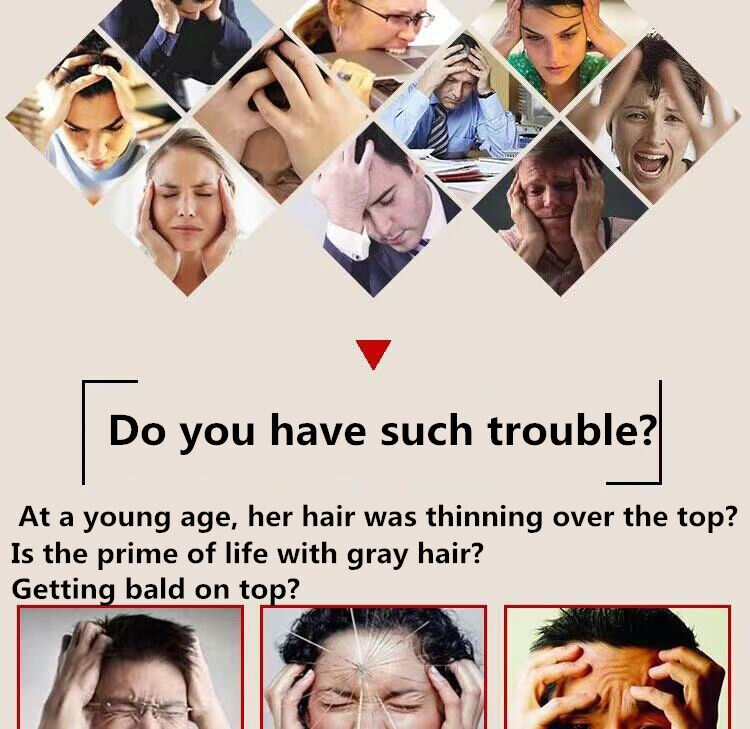 500g Prevent Hair Loss Herbal Pure Natural Chinese Troditional Hair Growth Herb