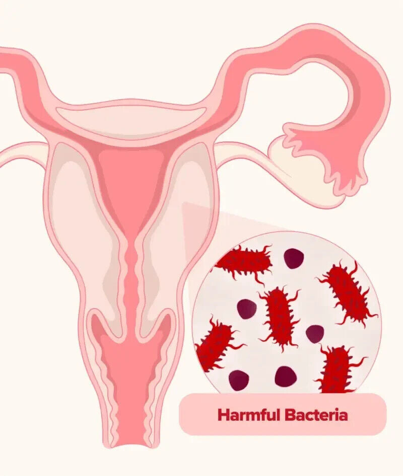 Vaginale Probiotika für Frauen pH-Balance mit Präbiotika & Lactobacillus, Neu
