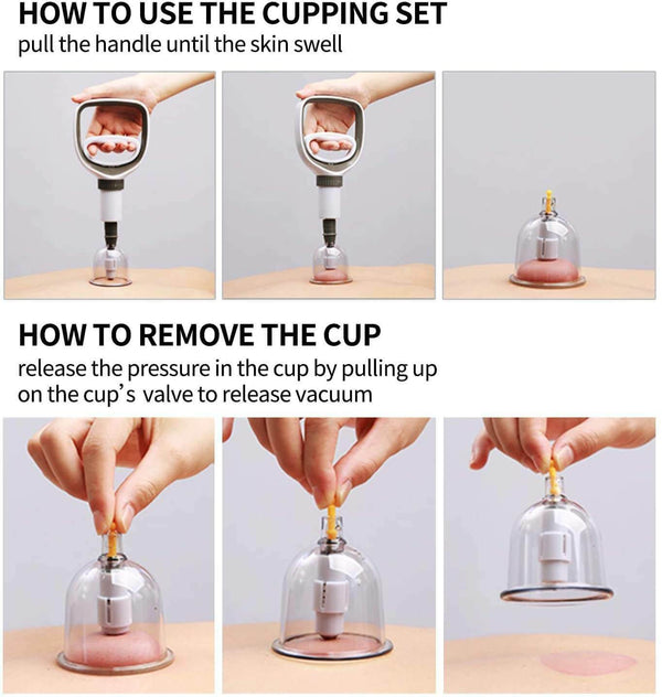 Professional Acupoint Cupping Set, 4th Generation Pump Gun & Cups (12 Cups)真空拔罐器
