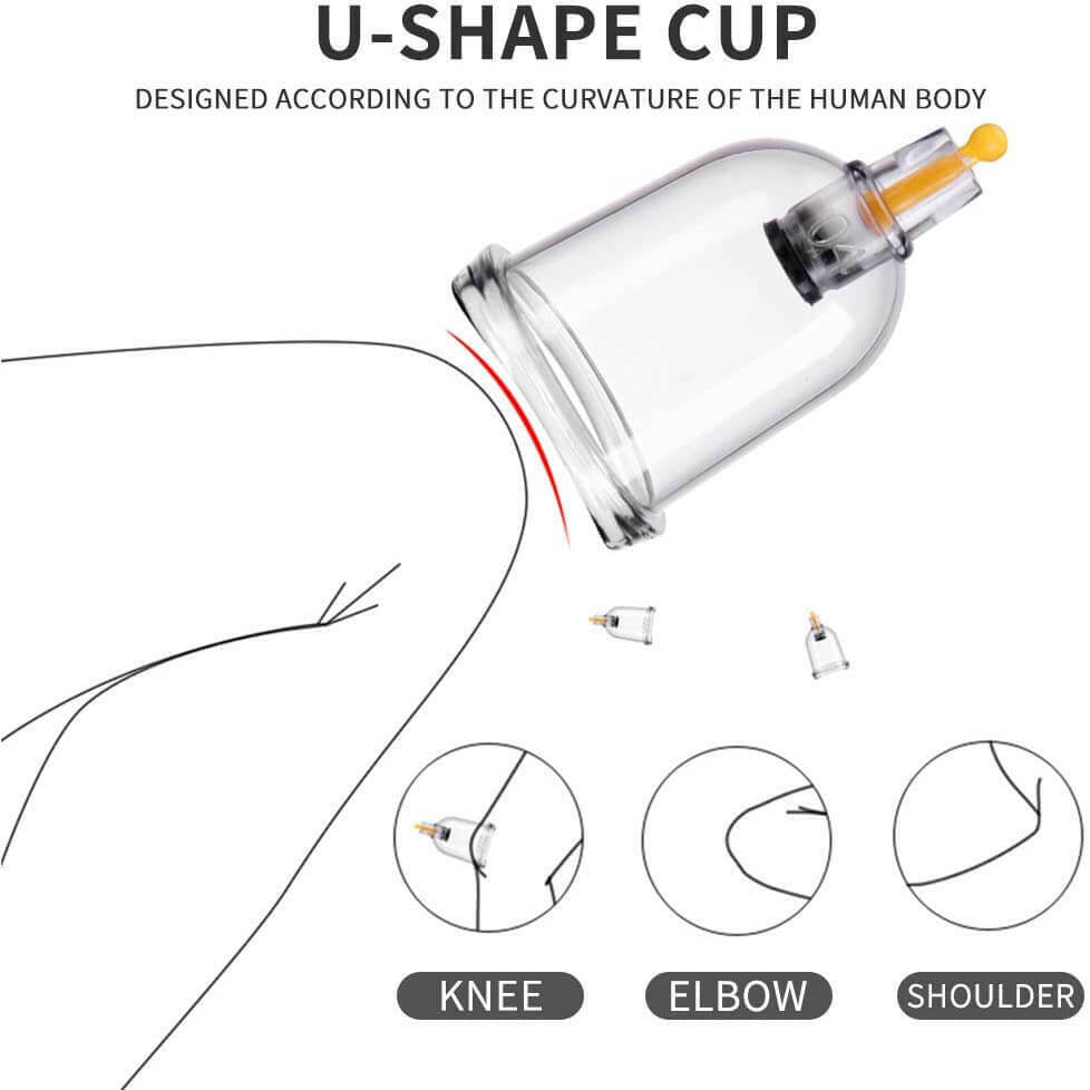 Professional Acupoint Cupping Set, 4th Generation Pump Gun & Cups (24 Cups) 真空拔罐器