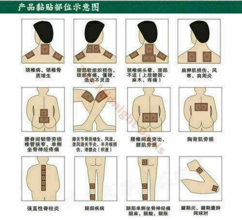 LingRui Zhuang Gu She Xiang Zhi Tong Gao 10 Bags（10Pcs/Bag）羚锐壮骨麝香止痛膏 10包（10片/包）